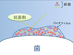 PMTC - 歯垢と歯石の中間の成熟したプラーク：バイオフィルム